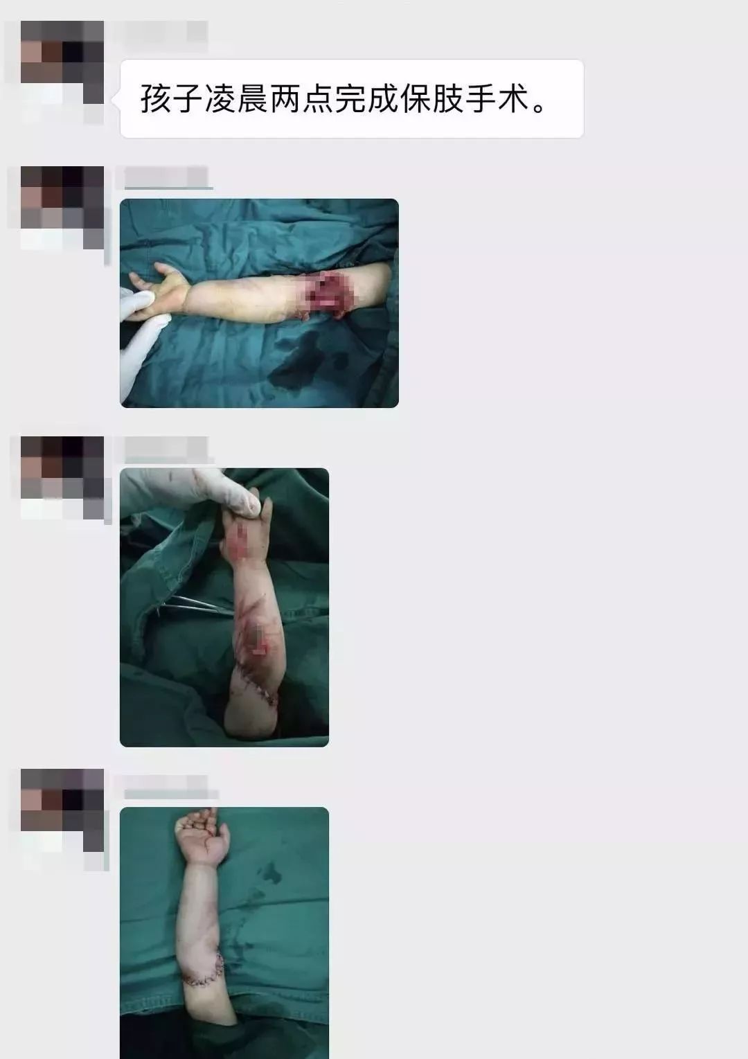 女童坐滑梯夹断小拇指,赔偿难题待解 女童坐滑梯夹断小拇指,赔偿难题待解